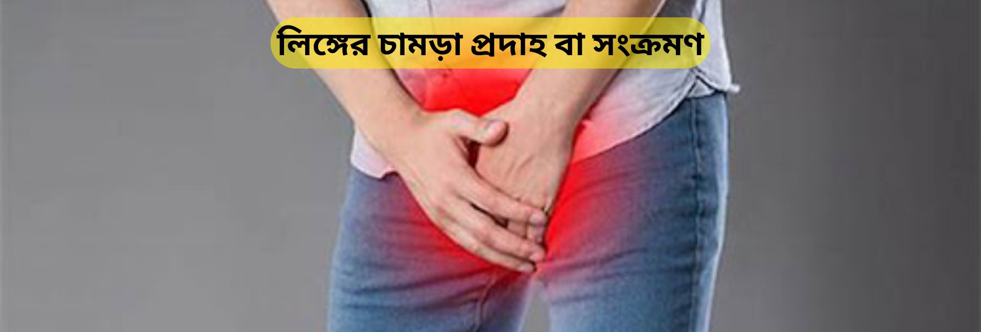 লিঙ্গের চামড়া প্রদাহ বা সংক্রমণ