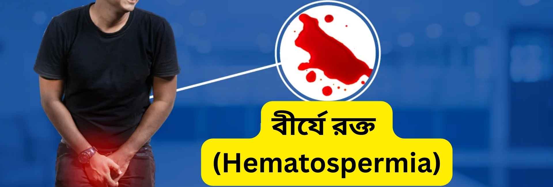 বীর্যে রক্ত: হেমাটোস্পার্মিয়া কী, কেন হয় এবং চিকিৎসা পদ্ধতি 1 বীর্যে রক্ত