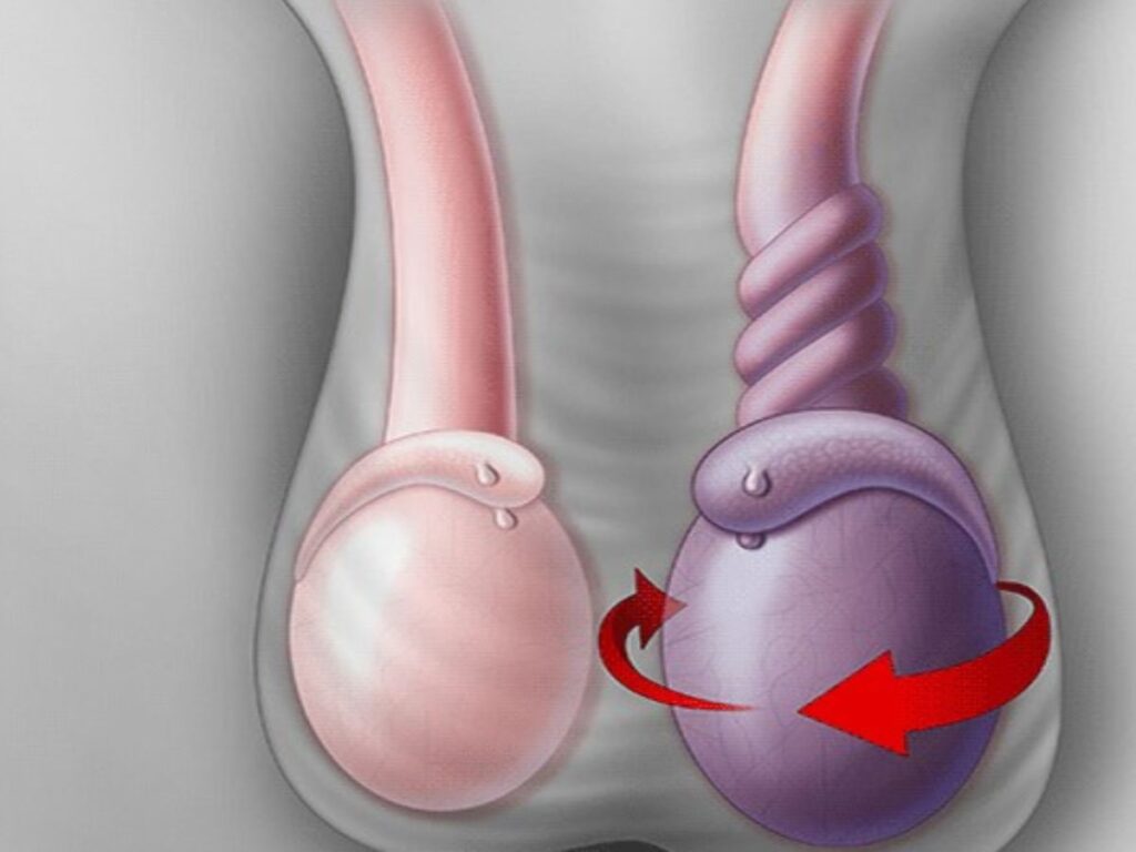 অণ্ডকোষ সমস্যা