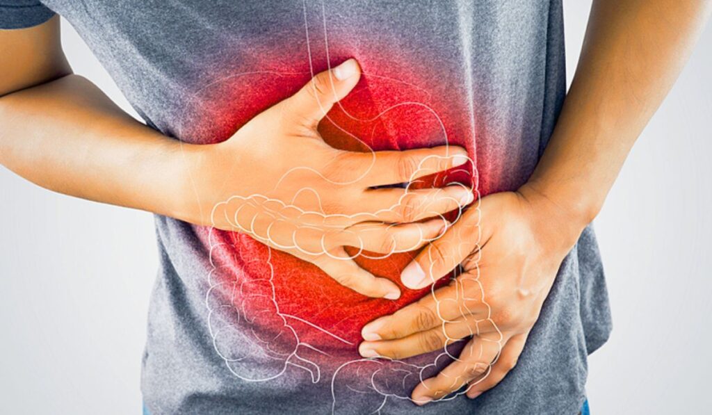 ইরিটেবল বাওয়েল সিনড্রোম (IBS) চিকিৎসা
