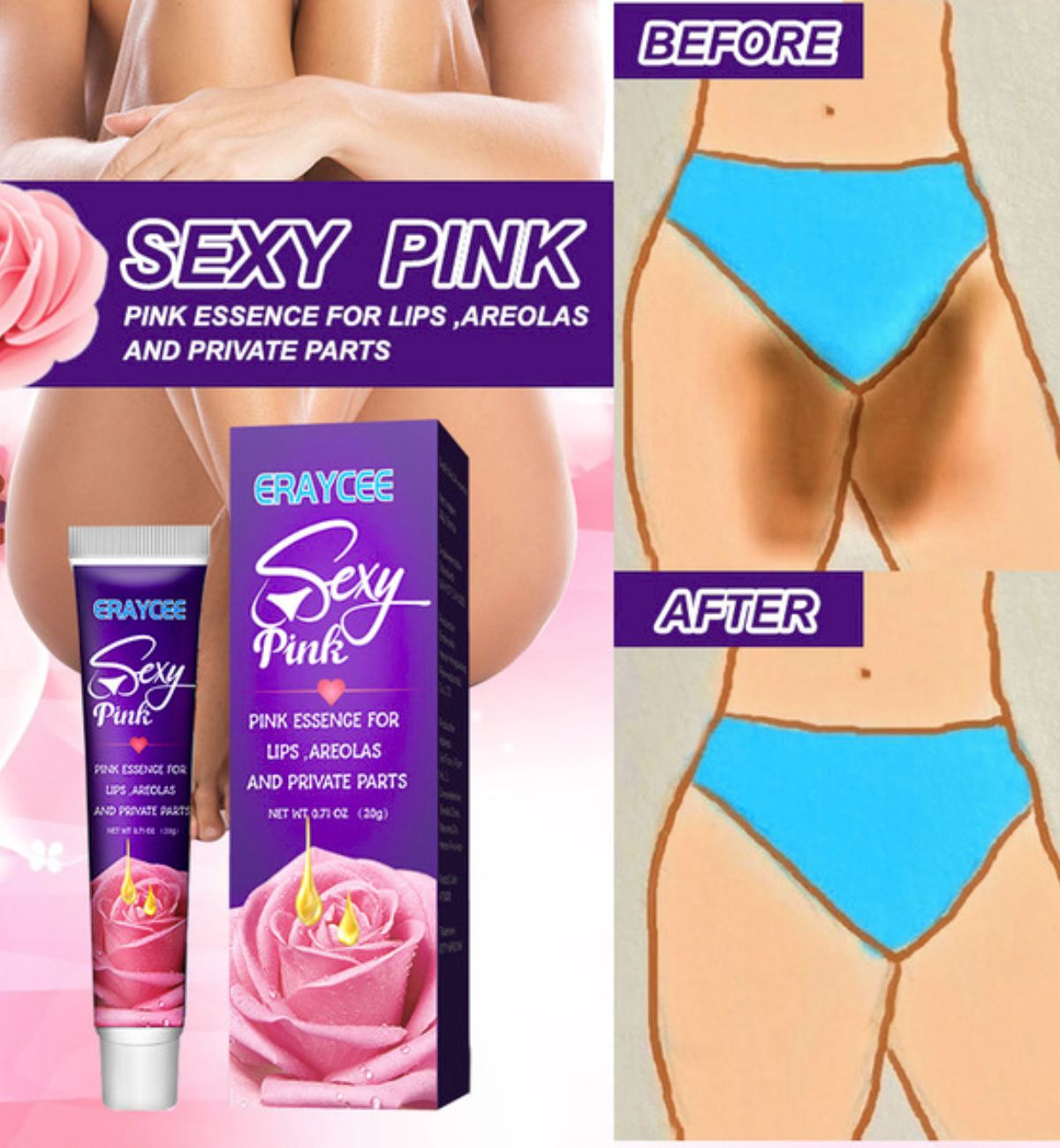 Eraycee Pink Vagina Cream: মেয়েদের গোপন অঙ্গ ফর্সা করার ক্রিম 3 লজ্জাস্থানের কালো দাগ দূর করার ক্রিম